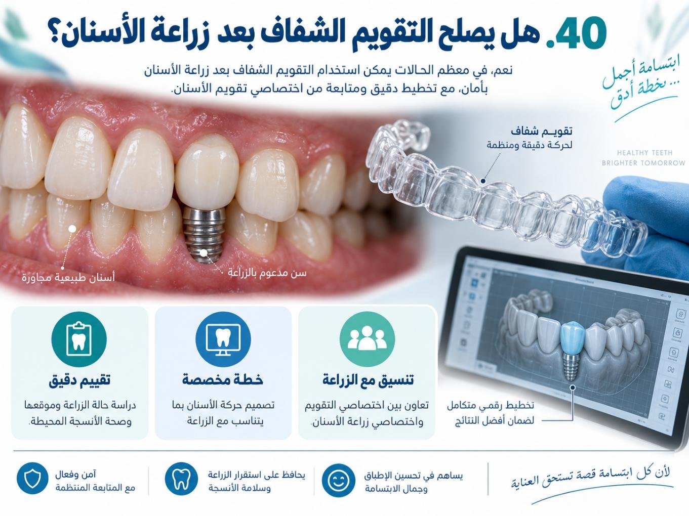 هل يصلح التقويم الشفاف بعد زراعة الأسنان؟