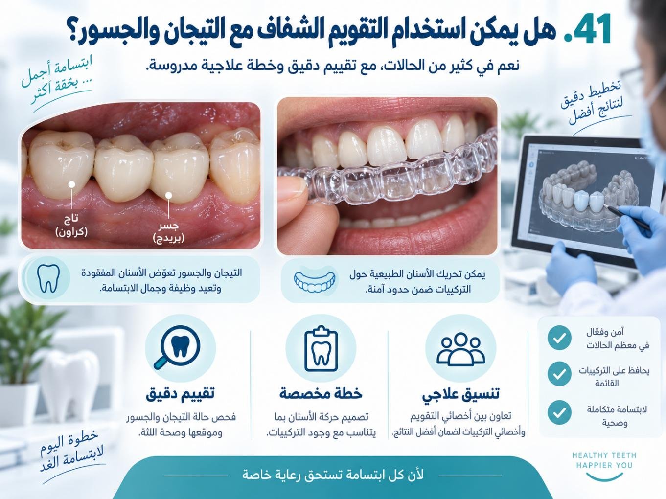 هل يمكن استخدام التقويم الشفاف مع التيجان والجسور؟