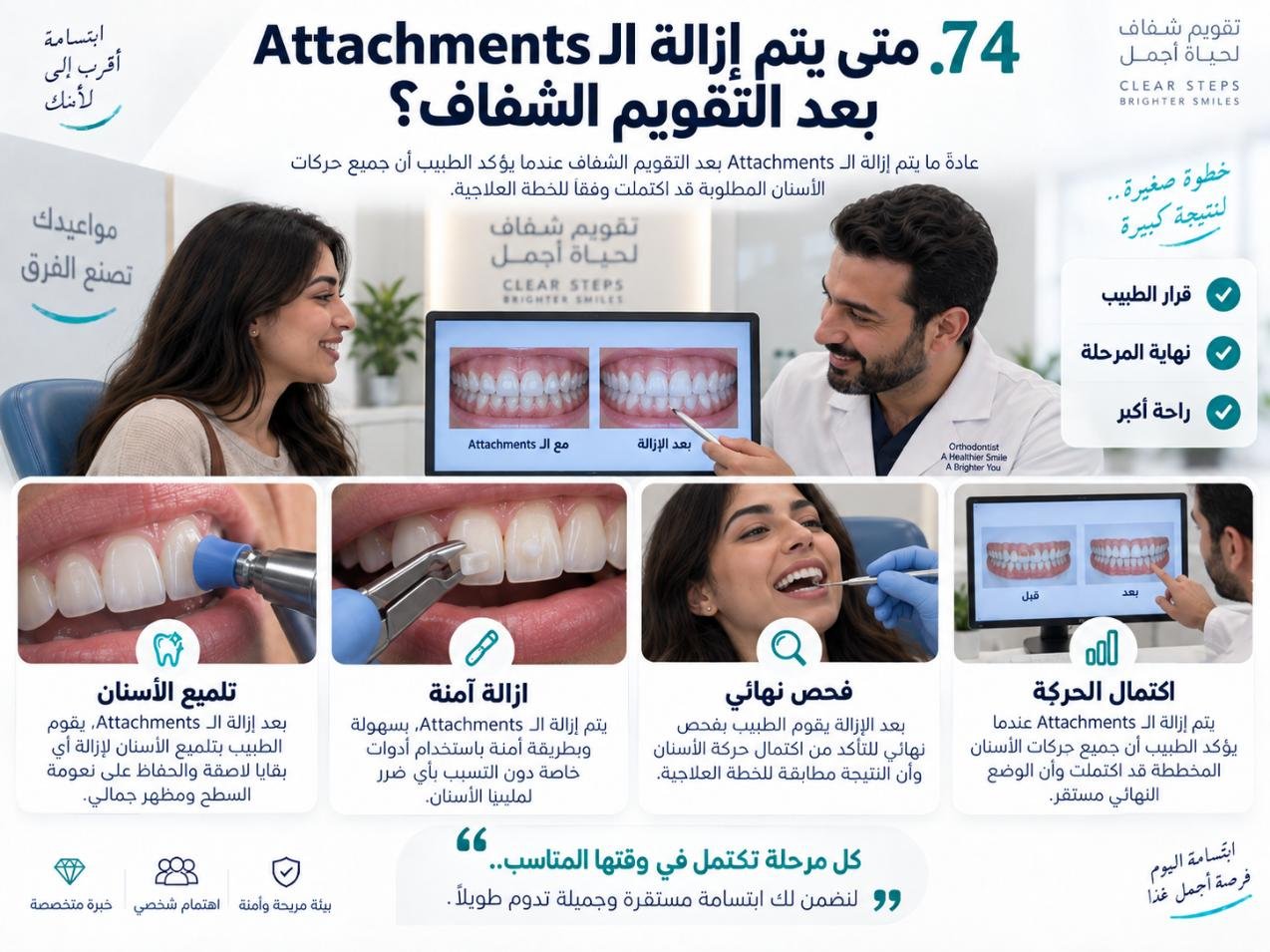 متى يتم إزالة الـ Attachments بعد التقويم الشفاف؟