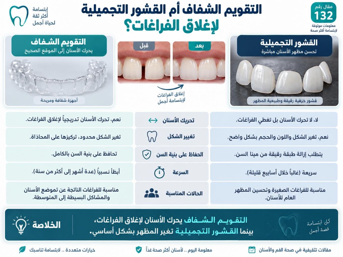 التقويم الشفاف أم القشور التجميلية لإغلاق الفراغات؟