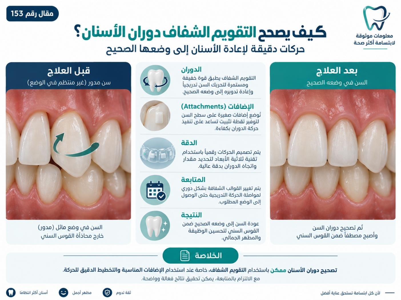 كيف يصحح التقويم الشفاف دوران الأسنان؟