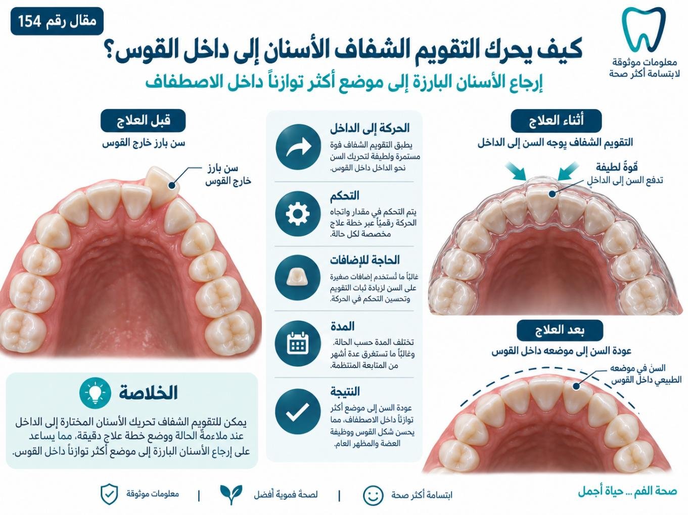 كيف يحرك التقويم الشفاف الأسنان إلى داخل القوس؟