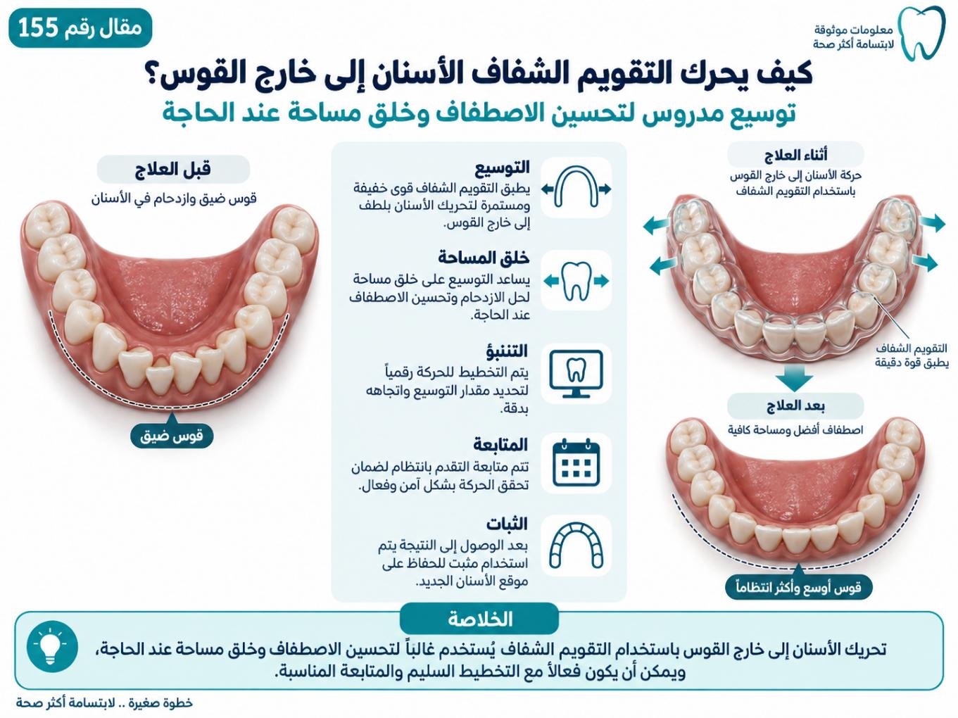 كيف يحرك التقويم الشفاف الأسنان إلى خارج القوس؟