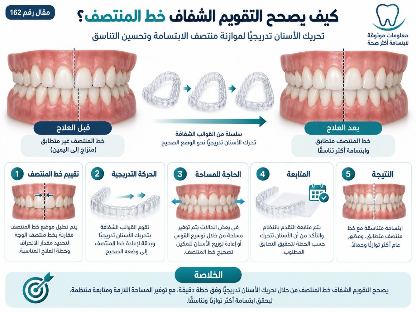 كيف يصحح التقويم الشفاف خط المنتصف؟