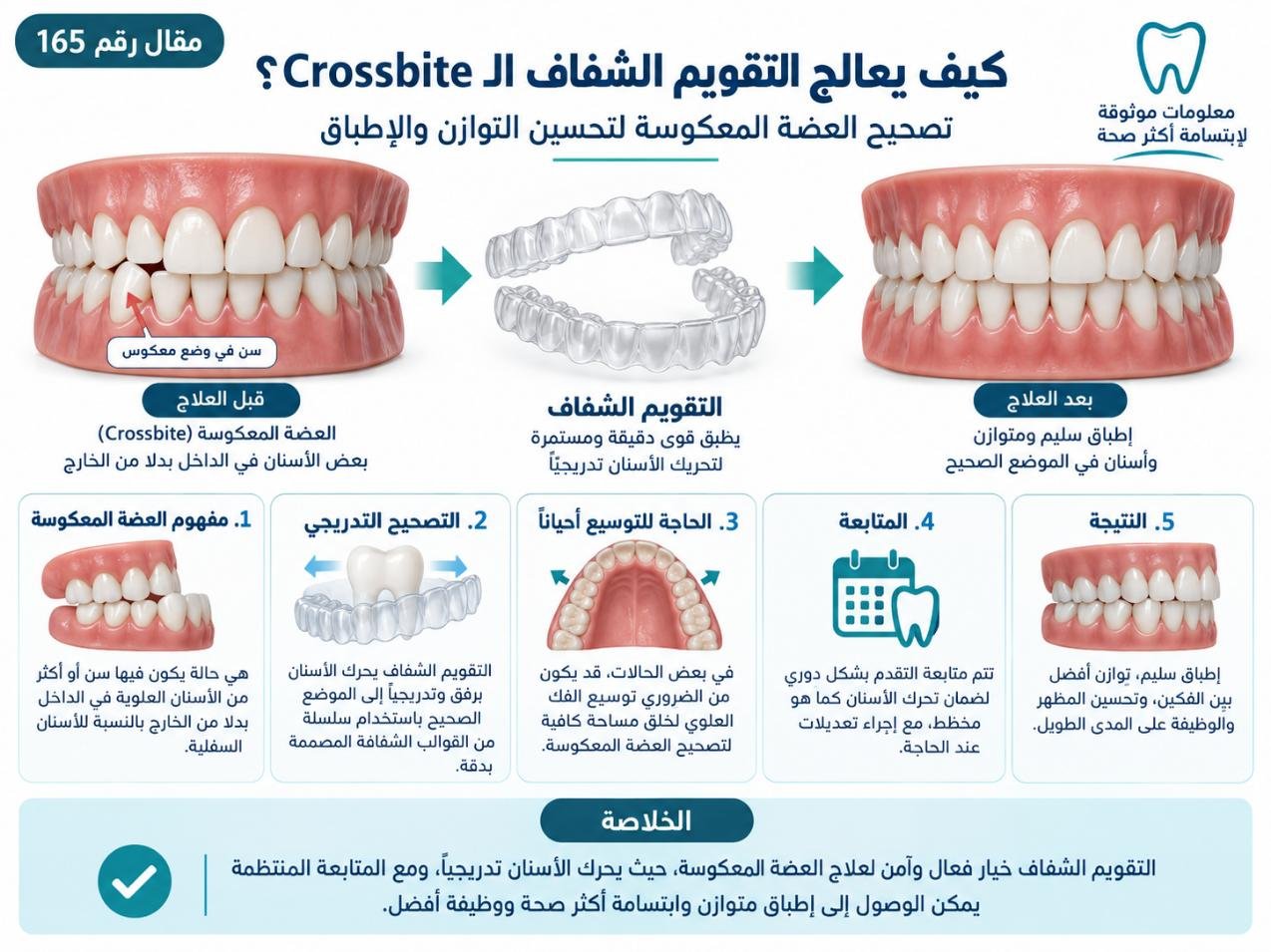 كيف يعالج التقويم الشفاف الـ Crossbite؟