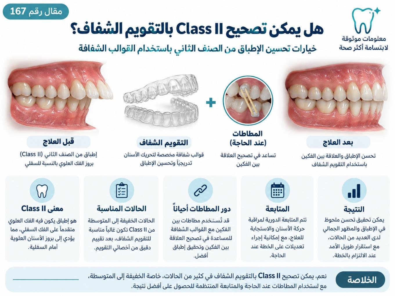هل يمكن تصحيح Class II بالتقويم الشفاف؟