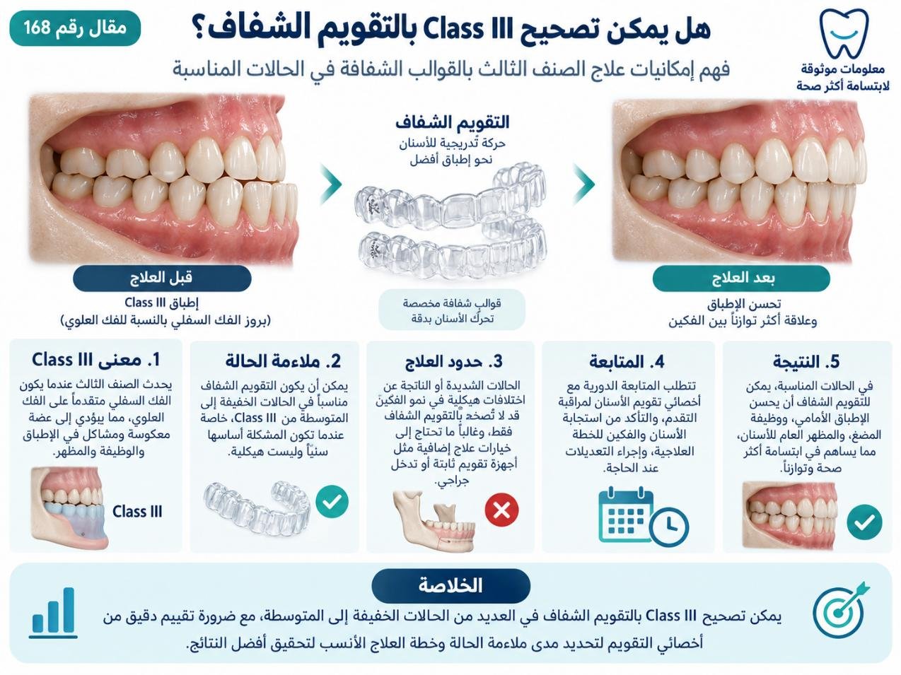 هل يمكن تصحيح Class III بالتقويم الشفاف؟