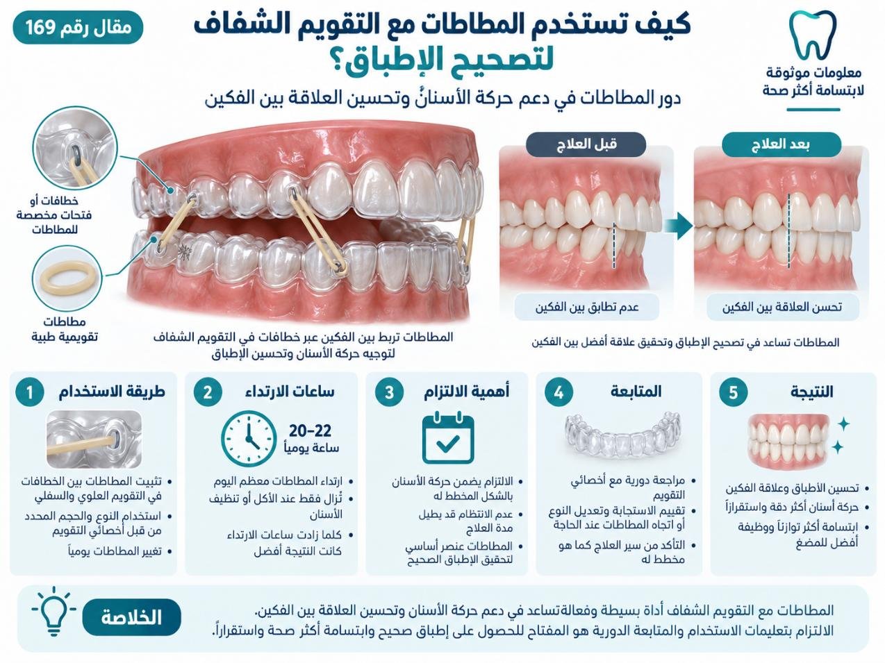 كيف تستخدم المطاطات مع التقويم الشفاف لتصحيح الإطباق؟