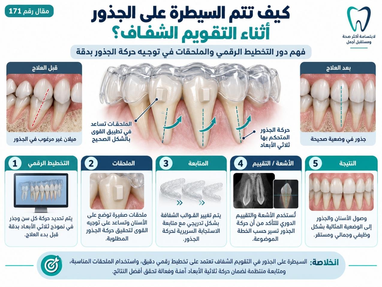 كيف تتم السيطرة على الجذور أثناء التقويم الشفاف؟