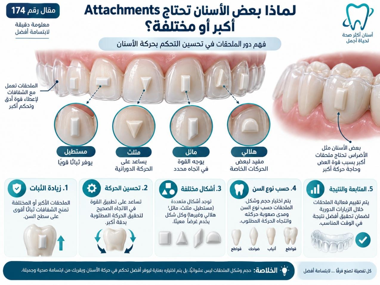 لماذا بعض الأسنان تحتاج Attachments أكبر أو مختلفة؟