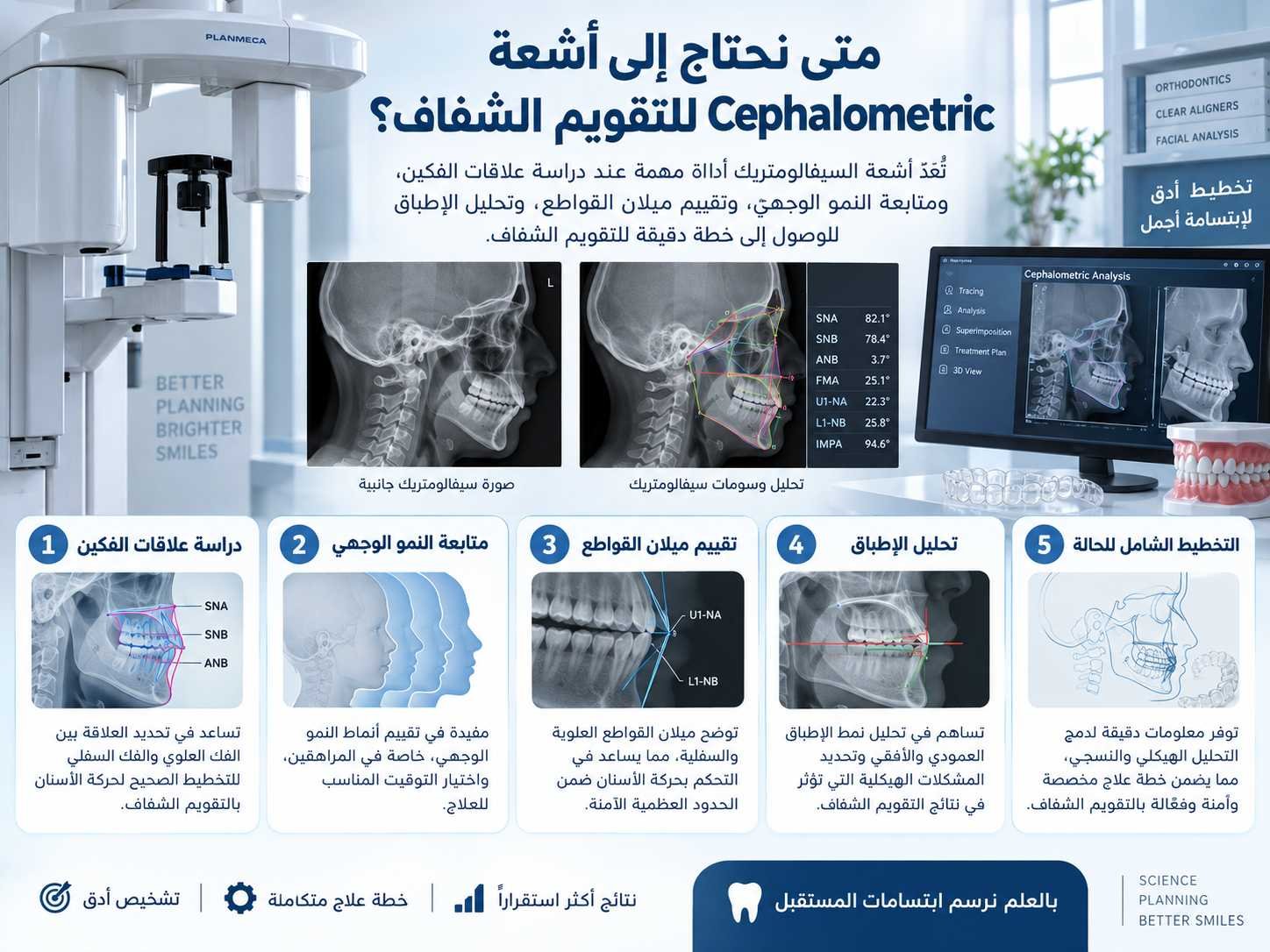 متى نحتاج إلى أشعة Cephalometric للتقويم الشفاف؟