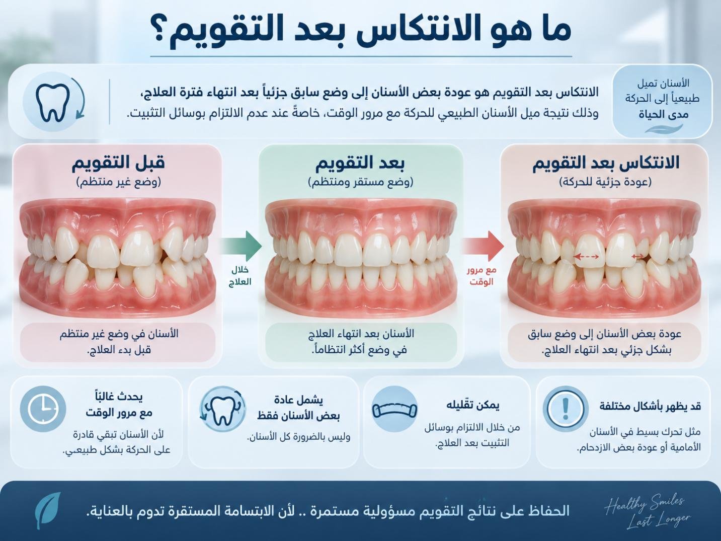 ما هو الانتكاس بعد التقويم؟