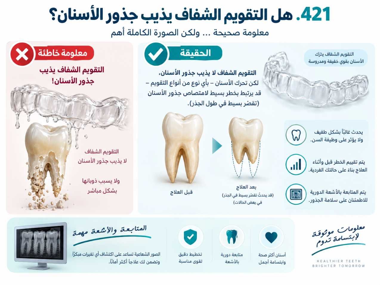 هل التقويم الشفاف يذيب جذور الأسنان؟