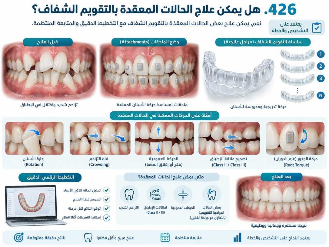 هل يمكن علاج الحالات المعقدة بالتقويم الشفاف؟