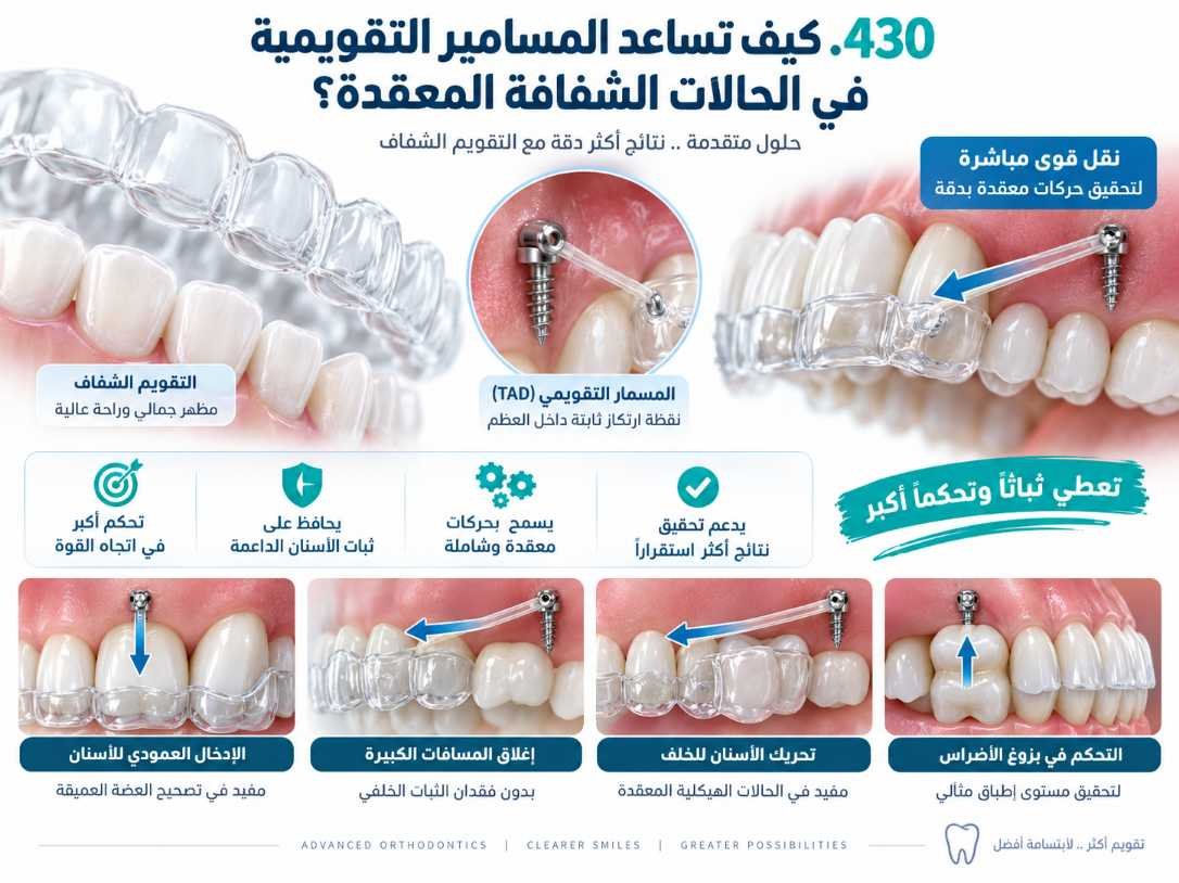 كيف تساعد المسامير التقويمية في الحالات الشفافة المعقدة؟