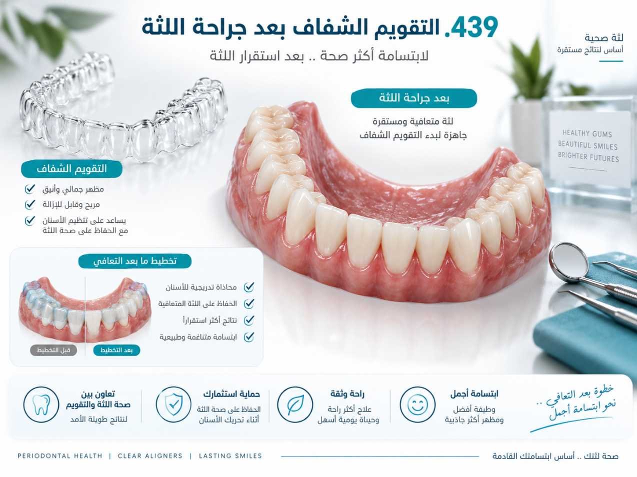 التقويم الشفاف بعد جراحة اللثة