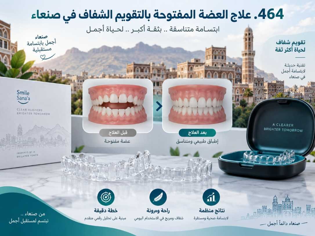 العضة المفتوحة والتقويم الشفاف: متى تكفي القوالب؟