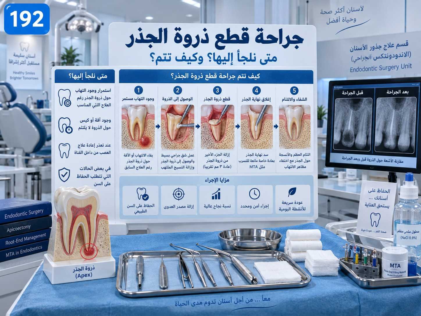جراحة قطع ذروة الجذر: الدواعي والخطوات والمتابعة