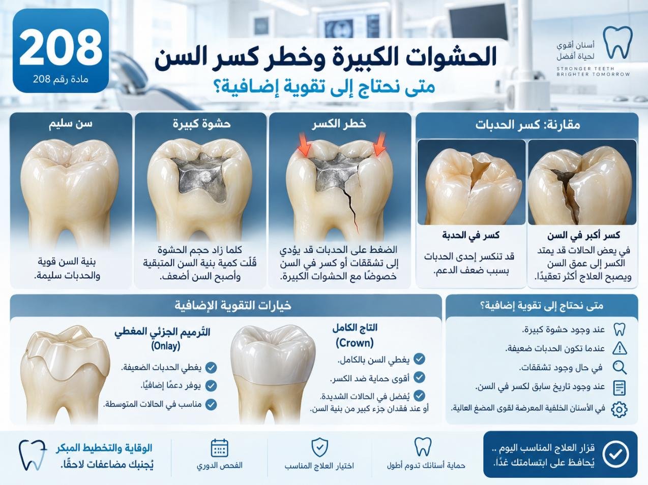 الحشوات الكبيرة وخطر كسر السن: الأسباب والتشخيص وخيارات العلاج