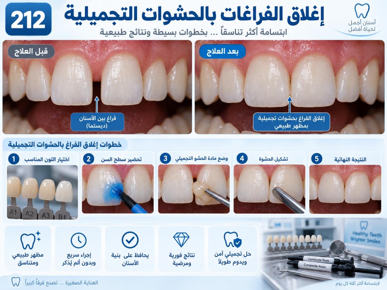 إغلاق الفراغات بالحشوات التجميلية: الأسباب والتشخيص وخيارات العلاج