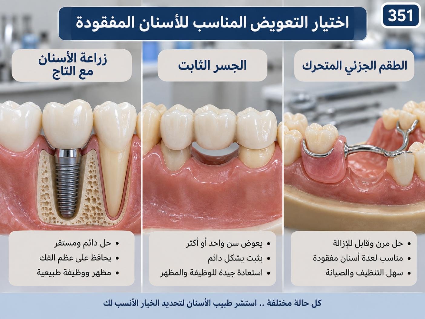 اختيار التعويض المناسب للأسنان المفقودة: الخيارات والخطوات والعناية