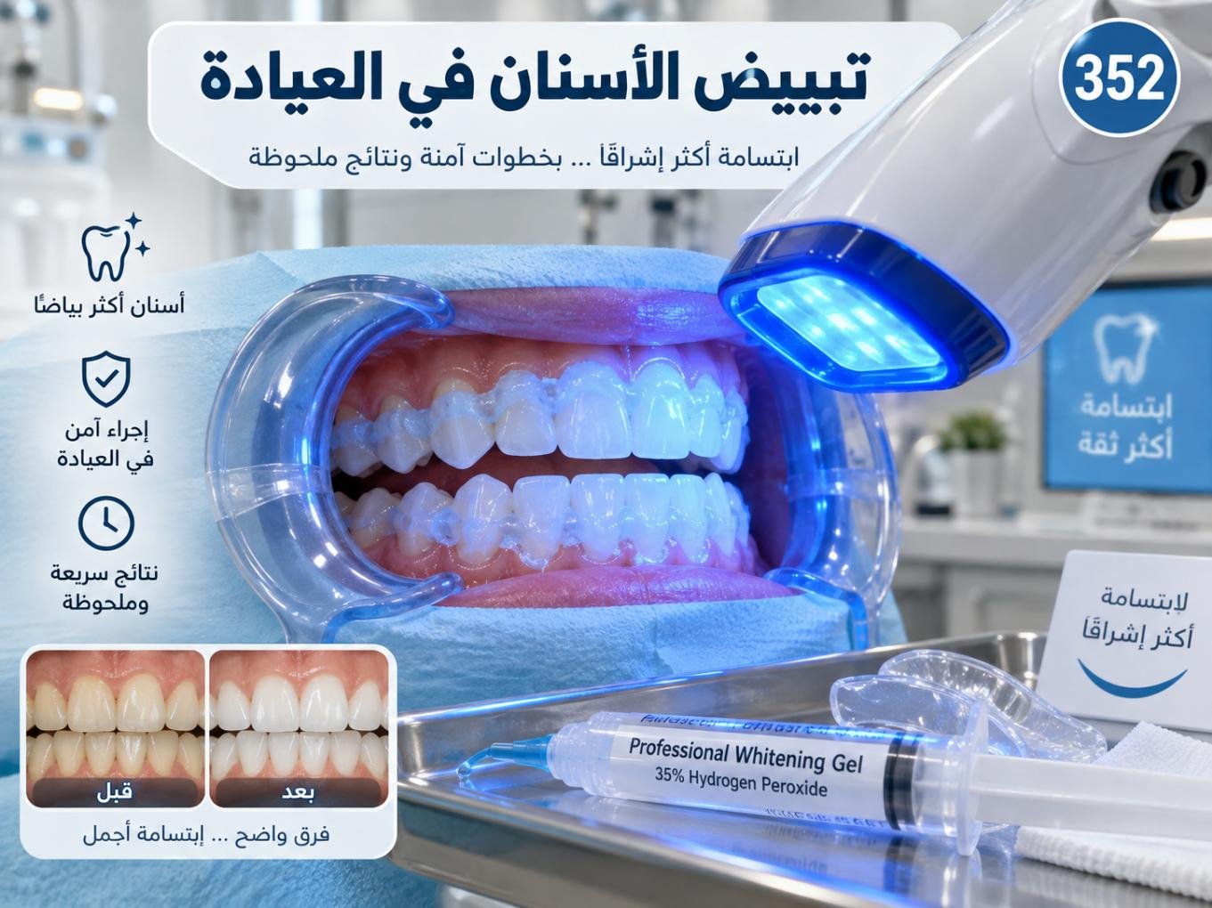 تبييض الأسنان في العيادة: الخيارات والنتائج والعناية